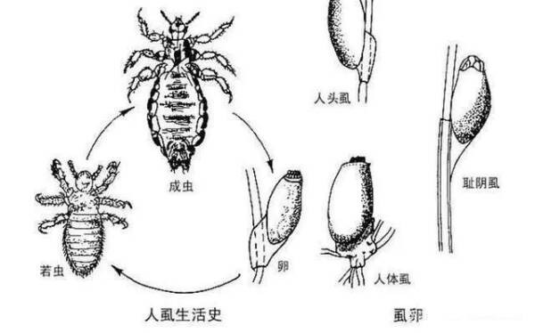 虱子的寿命及传播(虱子怎么快速去除)