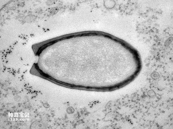 未知巨型病毒在3万年前冻土发现